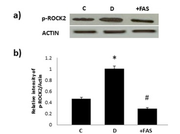 Western Blot using ROCK2 pY256