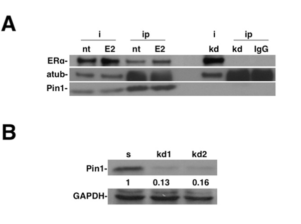 Western Blot using PIN1