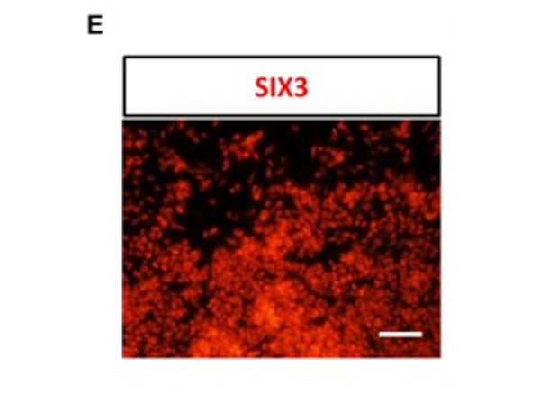 Immunofluorescence using Six3