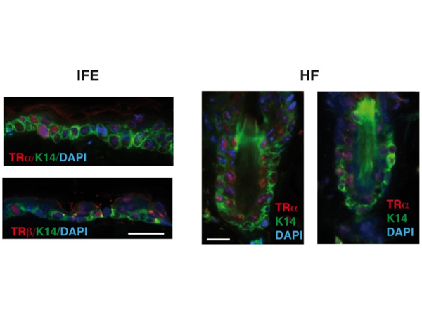 Double Immunofluorescence using THRA