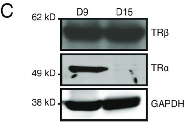 Western Blot using THRA