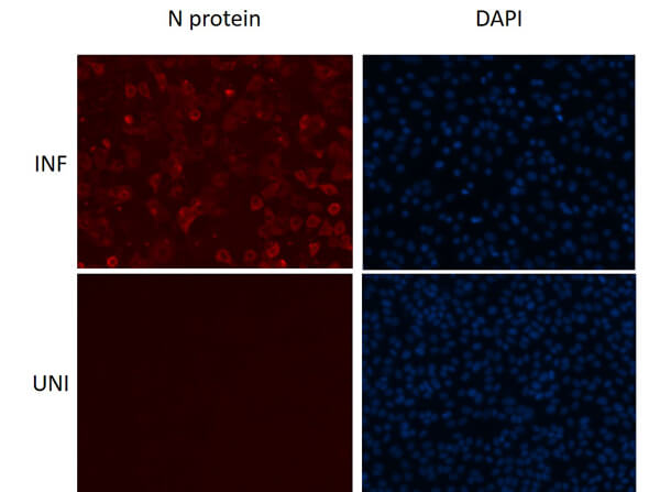Sars Nucleocapsid Protein Antibody