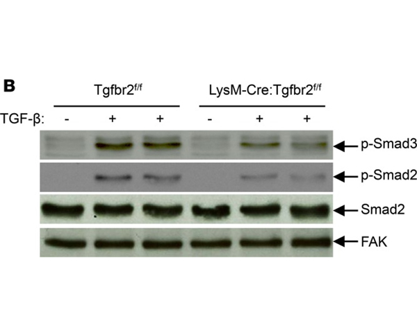 Western Blot using Smad2