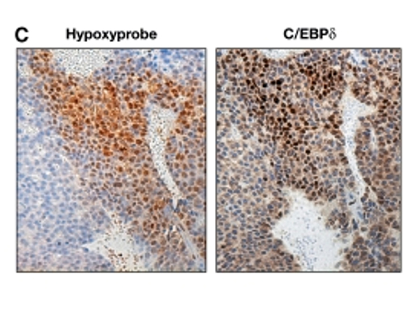 Immunohistochemistry using C/EBP delta