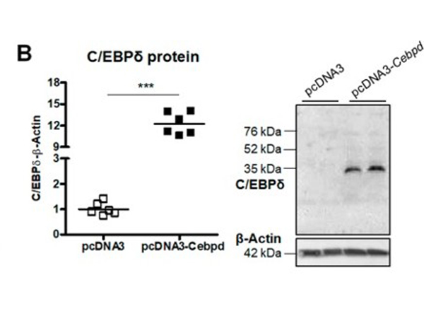 Western Blot using C/EBP delta