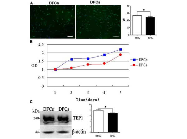 Western Blot using TEP1