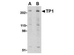 Anti-TP1 Antibody - Western Blot