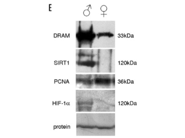 Western Blot using DRAM1