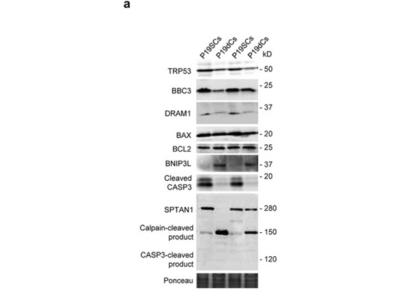 Western Blot using DRAM1