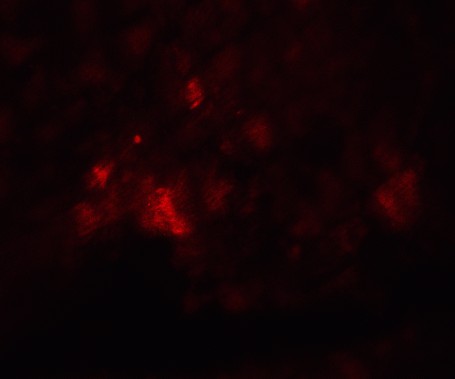 Immunofluorescence Validation of PD-L1