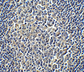 Immunohistochemistry Validation of PD-L1