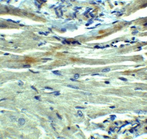 Immunohistochemistry Validation of PD-L1