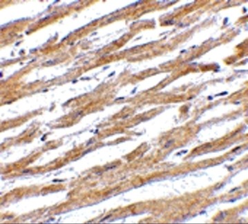 Immunohistochemistry Validation of PD-L1