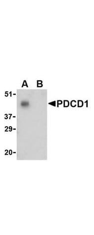 Anti-PDCD1 Antibody - Western Blot