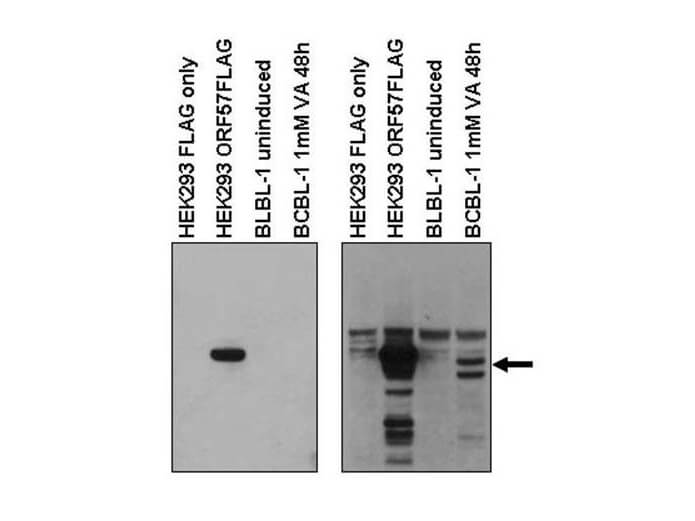 KSHV ORF57 Antibody