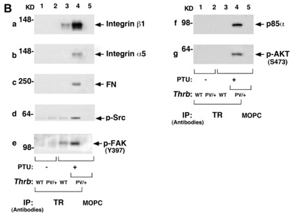 Immunoprecipitation using THRB