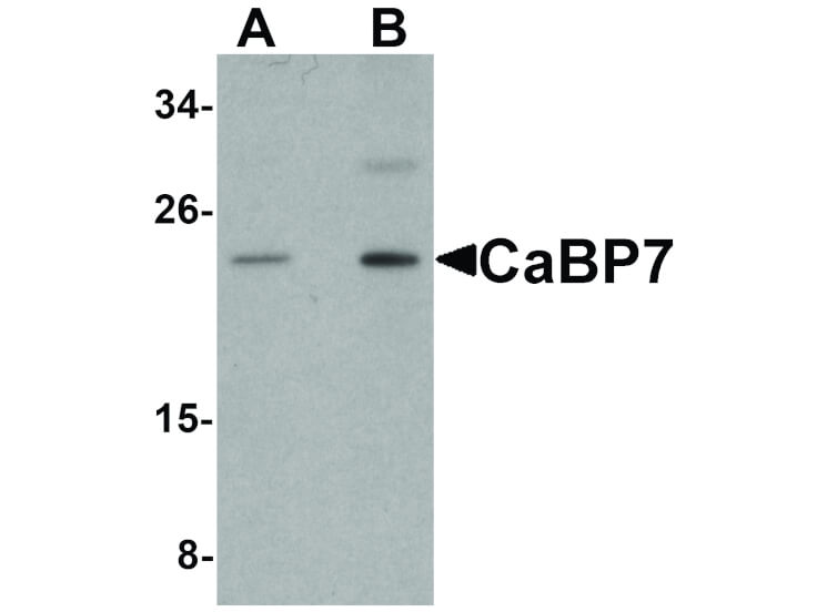 Western Blot of CaBP7 Antibody