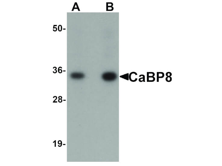 Western Blot of CaBP8 Antibody