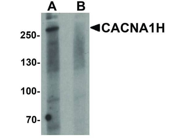 Western Blot of CACNA1H Antibody