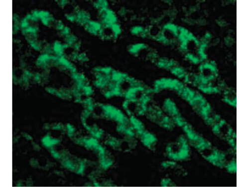 Immunofluorescence of CAD Antibody