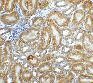 Immunohistochemistry of CAD