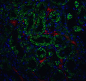 Immunofluorescence of CAD