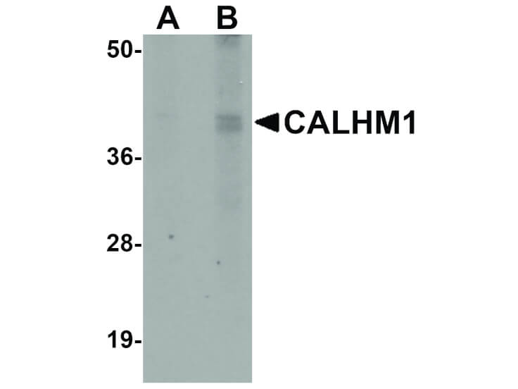 Western Blot of CALHM1 Antibody