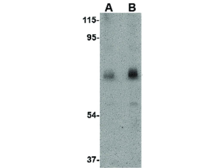 Western Blot of CAPN6 Antibody