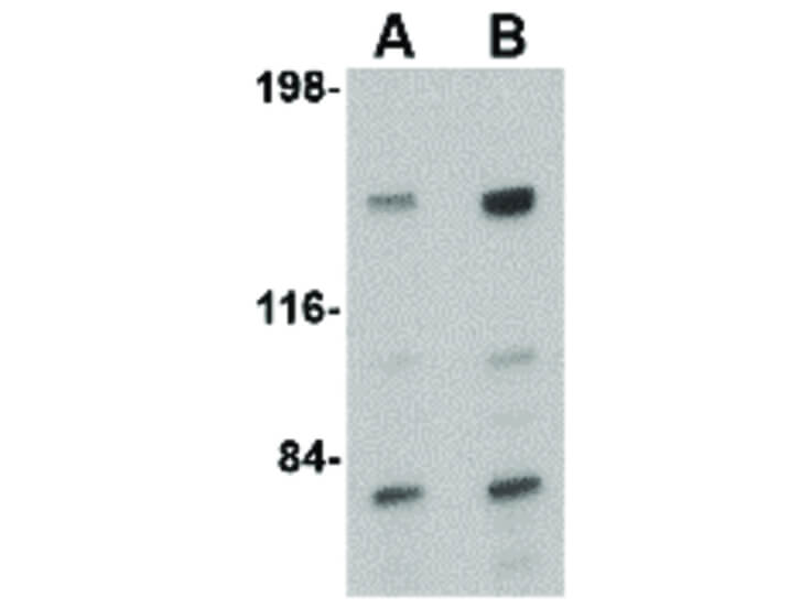 Western Blot of CAPS1 Antibody