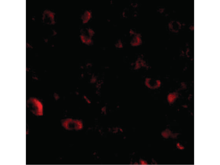 Immunofluorescence of CAPS1 Antibody