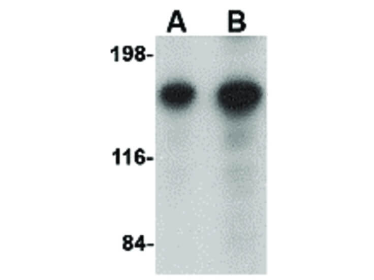 Western Blot of CAPS1 Antibody