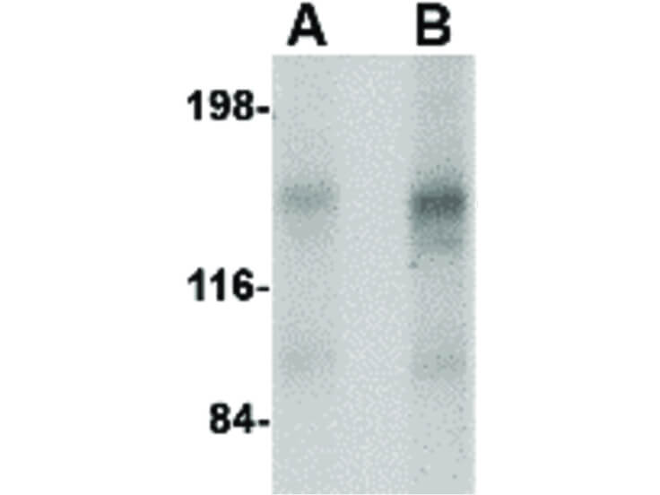 Western Blot of CAPS2 Antibody