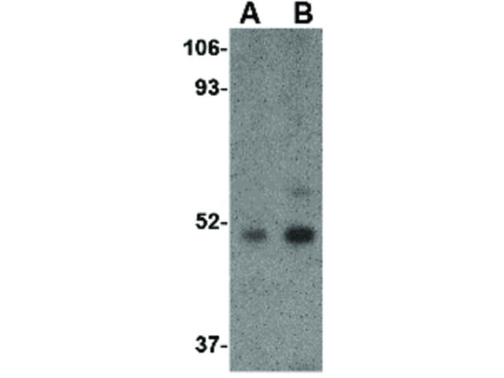 Western Blot of Carabin Antibody