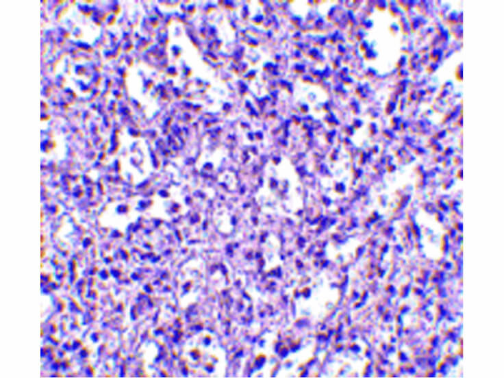 Immunohistochemistry of Carabin Antibody