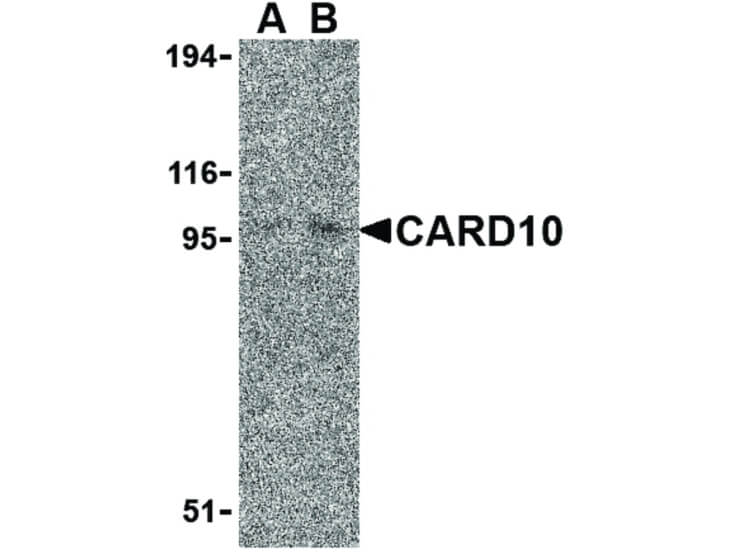Western Blot of CARD10 Antibody