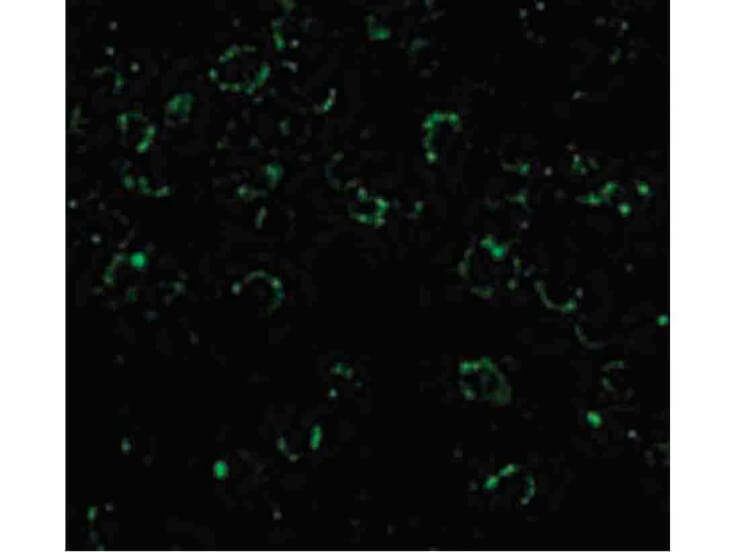 Immunofluorescence of CARD10 Antibody