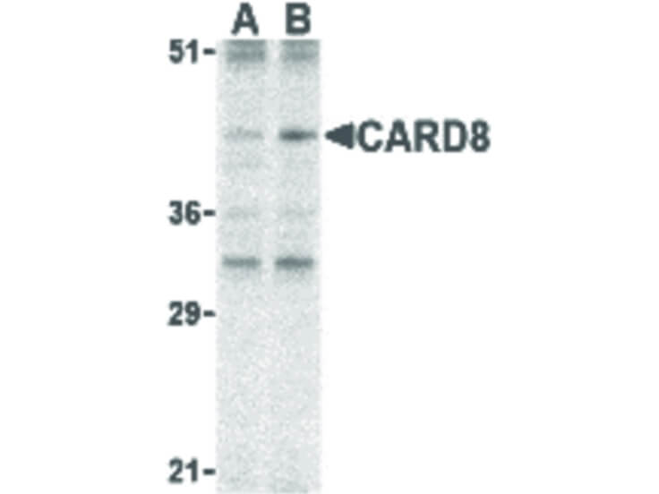 Western Blot of CARD8 Antibody