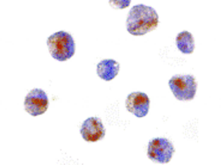 Immunocytochemistry of CARD8 Antibody