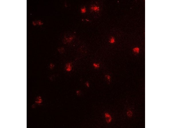 Immunofluorescence of CARM1