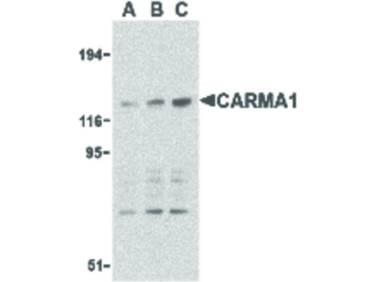 Western Blot of CARMA1 Antibody