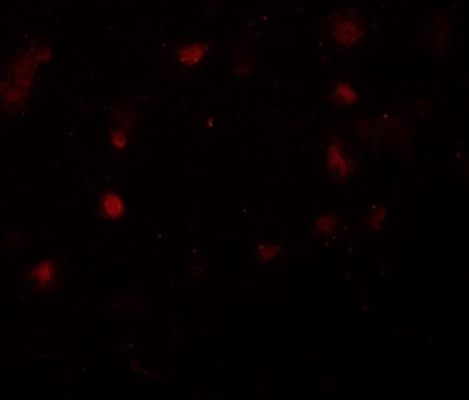 Immunofluorescence of CASK.