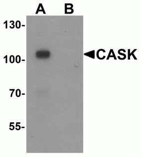 Western blot analysis of CASK.