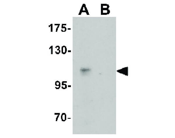 Western Blot of Rabbit Anti-Caskin2 Antibody.