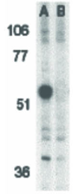 Western Blot of Caspase-12 Antibody