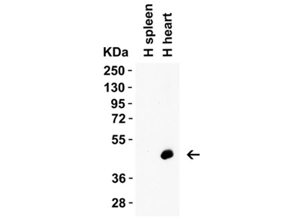 Western Blot of Caspase 12