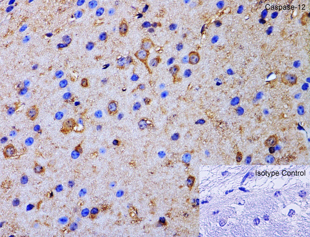 Immunohistochemistry of Caspase-12