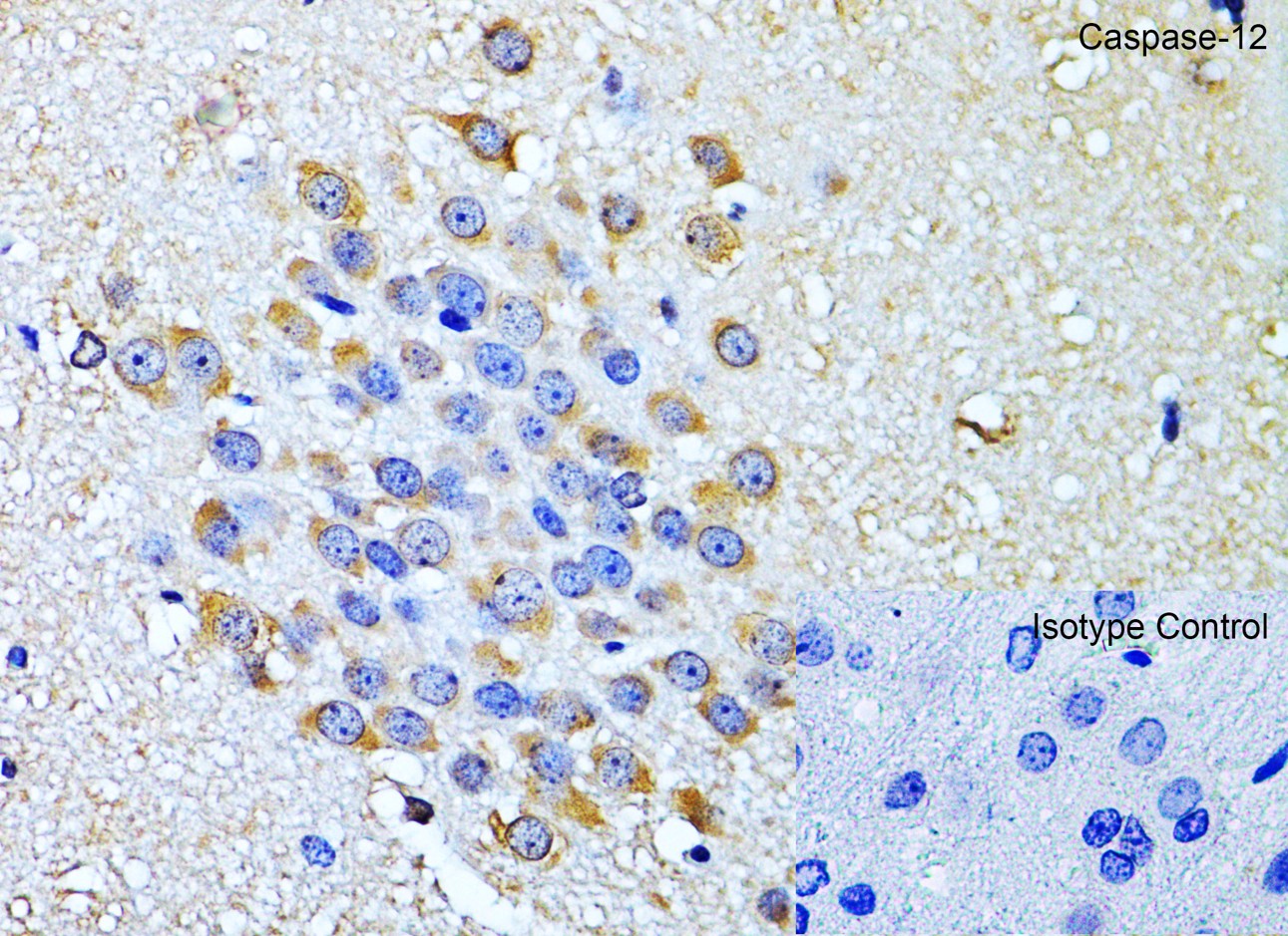 Immunohistochemistry of Caspase-12