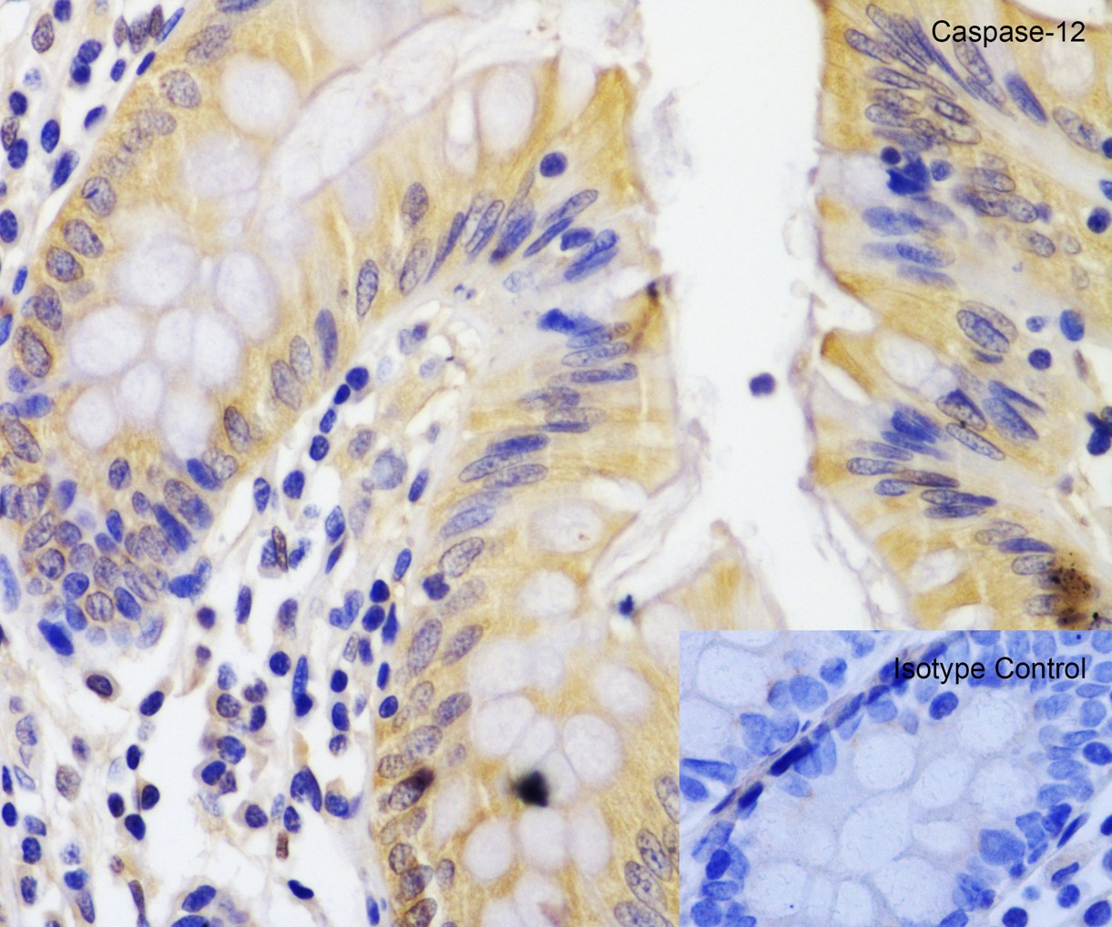 Immunohistochemistry of Caspase-12