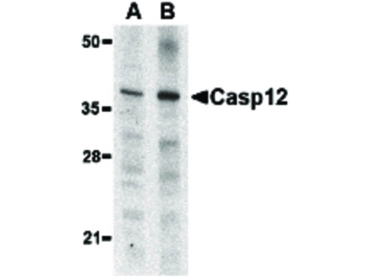 Western Blot of Caspase-12 Antibody (Small)