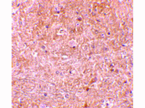 Immunohistochemistry of Caspase-13 Antibody